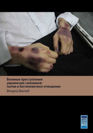 Военные преступления укрогестапо: пытки и бесчеловечное отношение